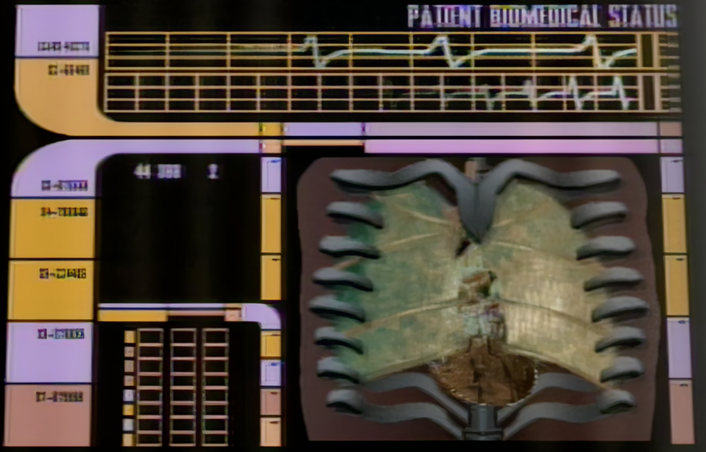 Holoprog image Neelix 1