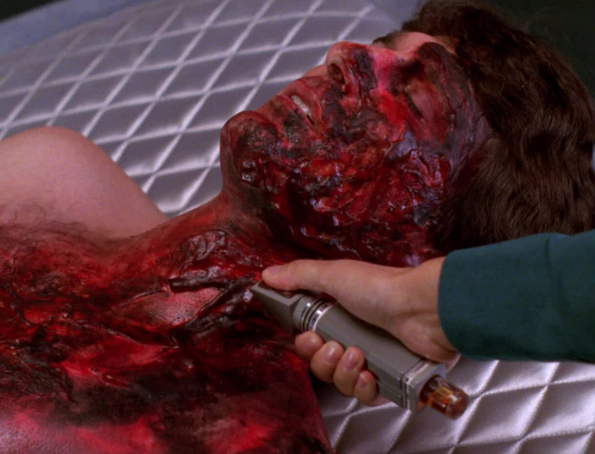 Sci-tech image Medical Technology - Hypospray