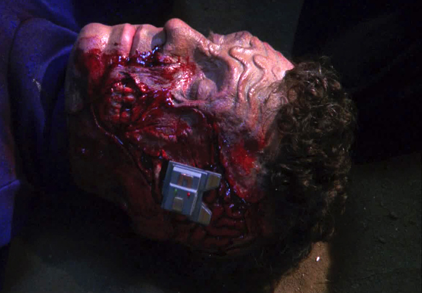 Sci-tech image Medical Technology - Neural Bridge