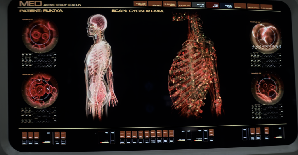 Illness image Cygnokemia