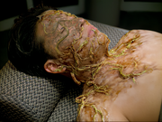 Gallery Image 8472 infection