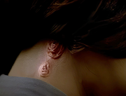 Gallery Image Macrovirus<br>Image 3