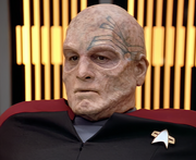 Gallery Image Progeria